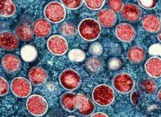 Deadly MPOX Variant Spreading Rapidly in Europe news-16082024-175914