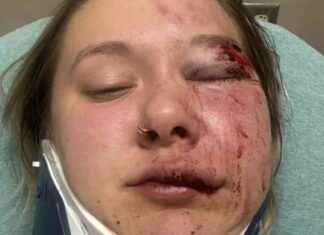 Michigan Woman Brutally Beaten After Uber Drops Her Off At Wrong Spot: Suspect Still At Large news-25092024-010114