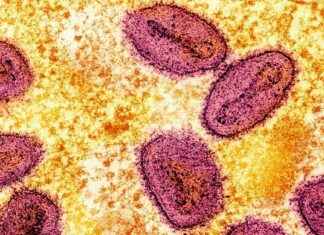 Title: Increase in Cases of Clade 1b Strain in UK Detected news-05112024-041508