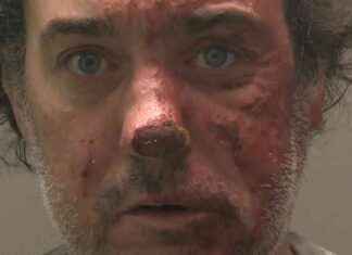 Man Admits Murder of Woman Set on Fire: Ellen Marshall Case Update news-09112024-043042