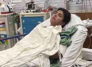 Rare Condition: Allergic Reaction to Exercise in US Woman – Only 0.05 Affected news-15112024-104829