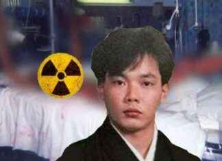 Hisashi Ouchi: Tragic Story of History’s Worst Radiation Death hisashi-ouchi-tragic-story-of-historys-worst-radiation-death